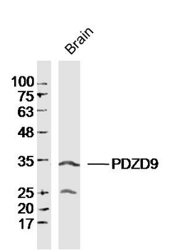 PDZD9 Rabbit Polyclonal Antibody