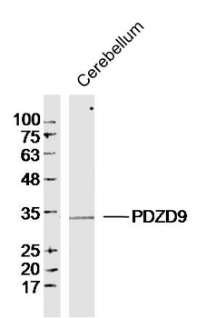 PDZD9 Rabbit Polyclonal Antibody