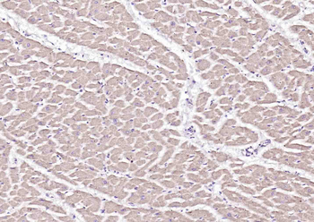 Laminin 2 alpha Rabbit Polyclonal Antibody