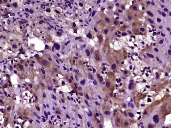 Laminin 2 alpha Rabbit Polyclonal Antibody