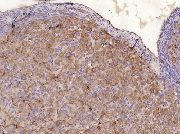 C-Kit Rabbit Polyclonal Antibody