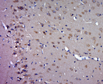 RNF61/MKRN1 Rabbit Polyclonal Antibody