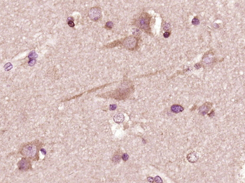 14-3-3 beta Rabbit Polyclonal Antibody