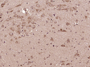 5HT1F Receptor Rabbit Polyclonal Antibody