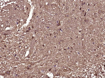 5HT1F Receptor Rabbit Polyclonal Antibody