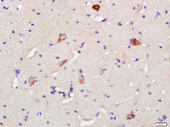 5HT1F Receptor Rabbit Polyclonal Antibody