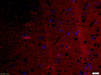 5HT1F Receptor Rabbit Polyclonal Antibody