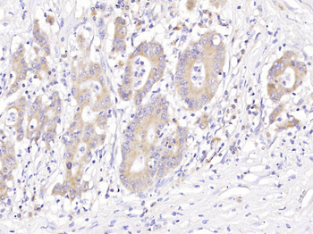 5HT2B Receptor Rabbit Polyclonal Antibody