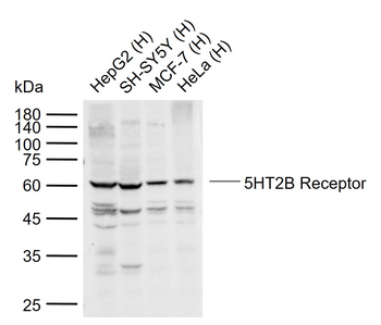 5HT2B Receptor Rabbit Polyclonal Antibody