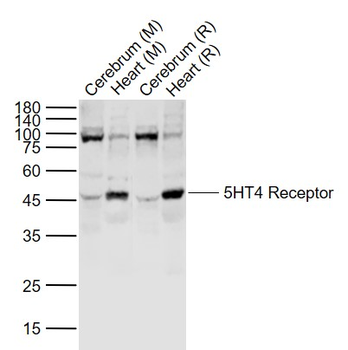 5HT4 Receptor Rabbit Polyclonal Antibody