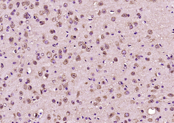 ABCB9 Rabbit Polyclonal Antibody