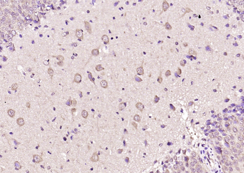 ABCB9 Rabbit Polyclonal Antibody