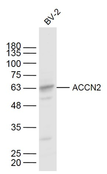 ACCN2 Rabbit Polyclonal Antibody