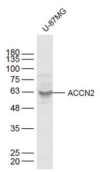 ACCN2 Rabbit Polyclonal Antibody