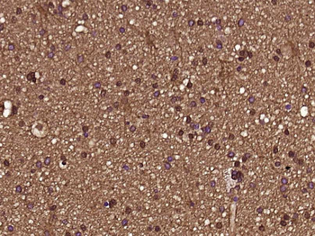 Phospho-ACTH (Ser168) Rabbit Polyclonal Antibody