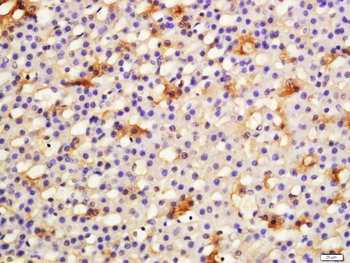 Phospho-ACTH (Ser168) Rabbit Polyclonal Antibody
