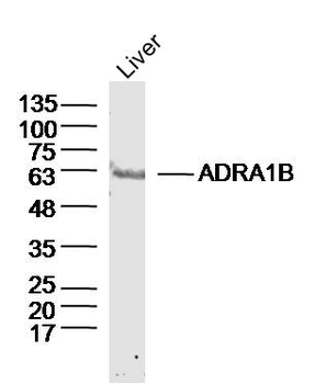 ADRA1B Rabbit Polyclonal Antibody