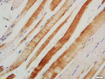 RAGE Rabbit Polyclonal Antibody