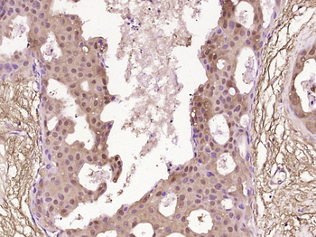 AKAP7 Rabbit Polyclonal Antibody