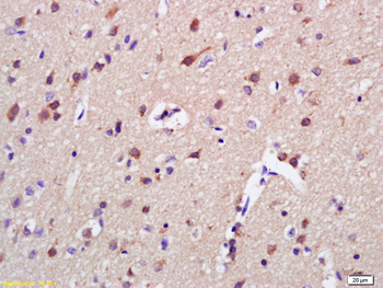 AKAP7 Rabbit Polyclonal Antibody