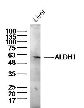 ALDH1A1 Rabbit Polyclonal Antibody