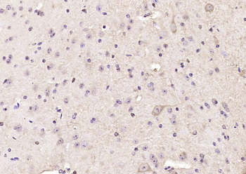 Alpha + beta Synuclein Rabbit Polyclonal Antibody