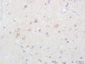 Alpha + beta Synuclein Rabbit Polyclonal Antibody