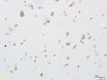 Alpha + beta Synuclein Rabbit Polyclonal Antibody