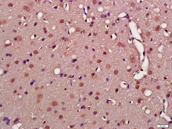 Alpha-synuclein (nitro-Tyr39) Rabbit Polyclonal Antibody