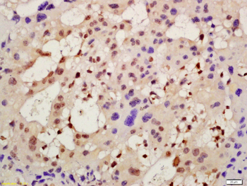 AMIGO2 Rabbit Polyclonal Antibody