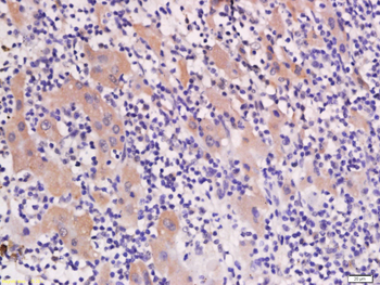 AP1M2 Rabbit Polyclonal Antibody