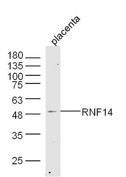 RNF14 Rabbit Polyclonal Antibody