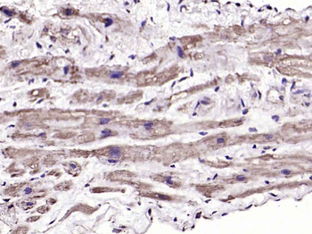 APPBP1 Rabbit Polyclonal Antibody