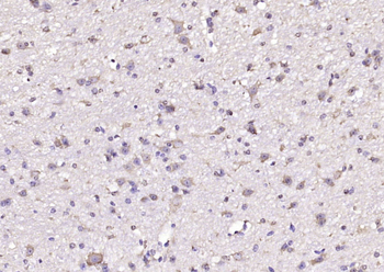 Arginyl tRNA synthetase Rabbit Polyclonal Antibody