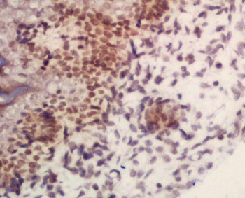 ARID1B Rabbit Polyclonal Antibody