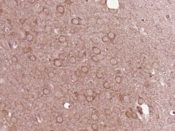 ARP2 Rabbit Polyclonal Antibody