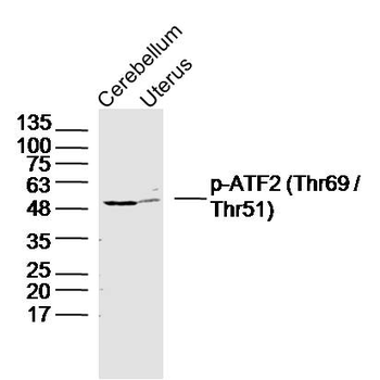Phospho-ATF2 (Thr69 / Thr51) Rabbit Polyclonal Antibody