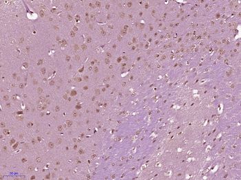 ATF6 beta Rabbit Polyclonal Antibody