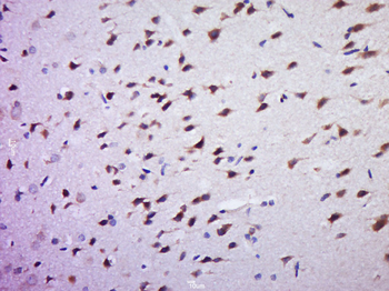 Phospho-BRAF (Thr598 + Ser601) Rabbit Polyclonal Antibody