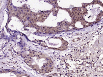 Phospho-BRAF (Thr598) Rabbit Polyclonal Antibody