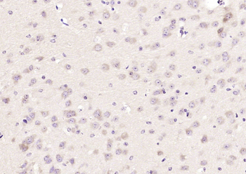 BACE2 Rabbit Polyclonal Antibody