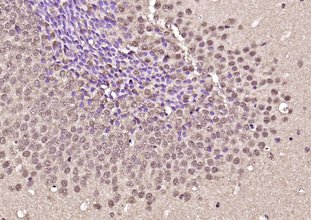 BAF53A Rabbit Polyclonal Antibody