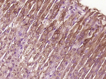 TTC8 Rabbit Polyclonal Antibody