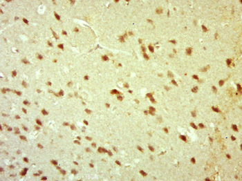Phospho-beta Catenin (Thr41) Rabbit Polyclonal Antibody
