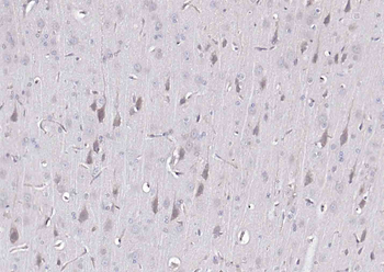Beta-Amyloid (1-42) Mouse Monoclonal Antibody