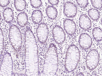 Phospho-BRAF (Ser729) Rabbit Polyclonal Antibody