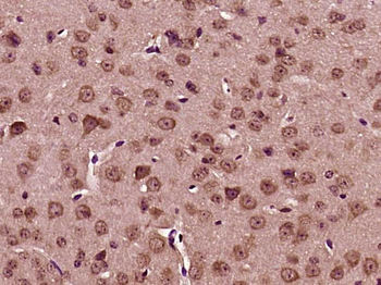 BRAF35 Rabbit Polyclonal Antibody