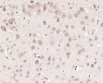 BRMS1 Rabbit Polyclonal Antibody