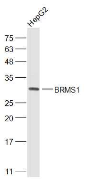 BRMS1 Rabbit Polyclonal Antibody
