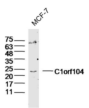 C1orf104 Rabbit Polyclonal Antibody